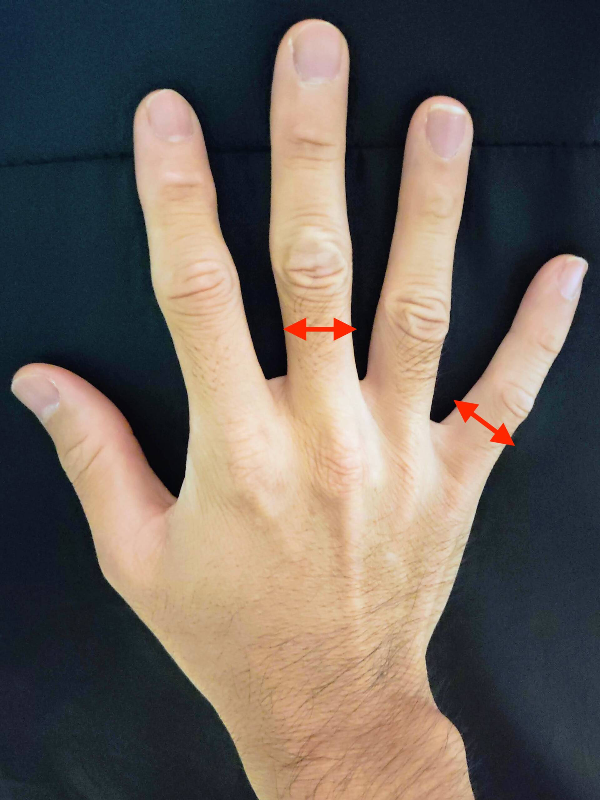 ブログ筆者の手の指を計測する画像
